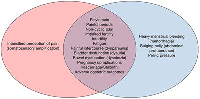 Endometriosis and Uterine Fibroids (Leiomyomata): Comorbidity, Risks and Implications